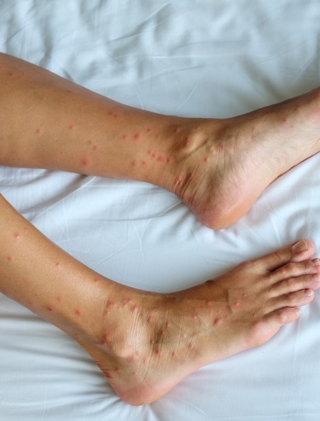 Pourquoi l'intervention canine pour les punaises de lit est-elle bénéfique?